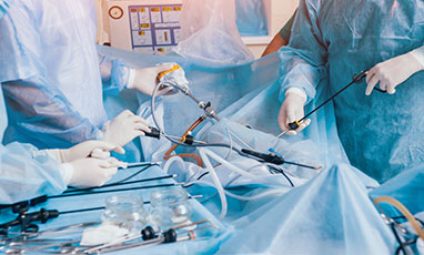 laparoscopy image